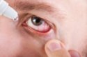 Not using the right contact lens solution can be very damaging to your eyes