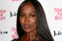 Naomi Campbell suffers from women's hair loss