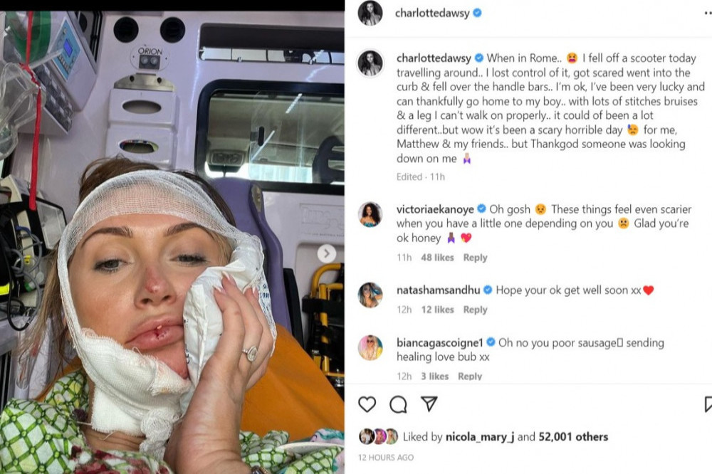 Charlotte Dawson Rushed To Hospital After Losing Control Of Scooter