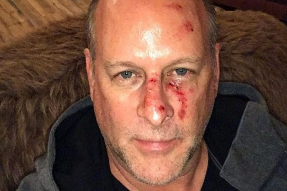 Dave Coulier reveals his struggles with alcohol (C) Dave Coulier/Instagram