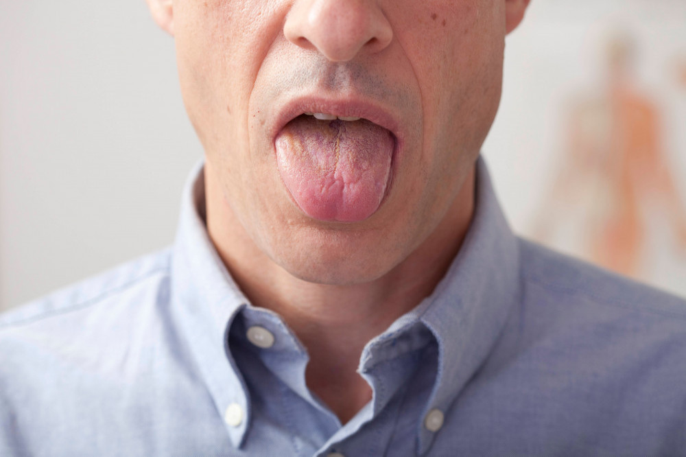 Diseases can be diagnosed by studying the colour of a person's tongue