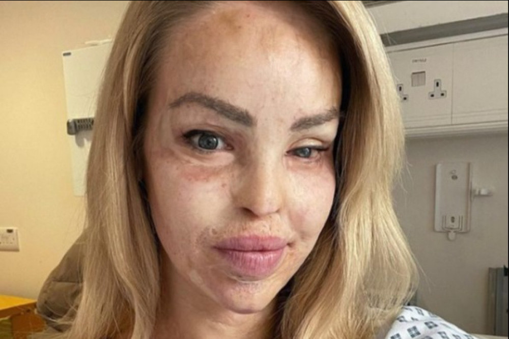 Katie Piper (c) instagram.com/katiepiper_