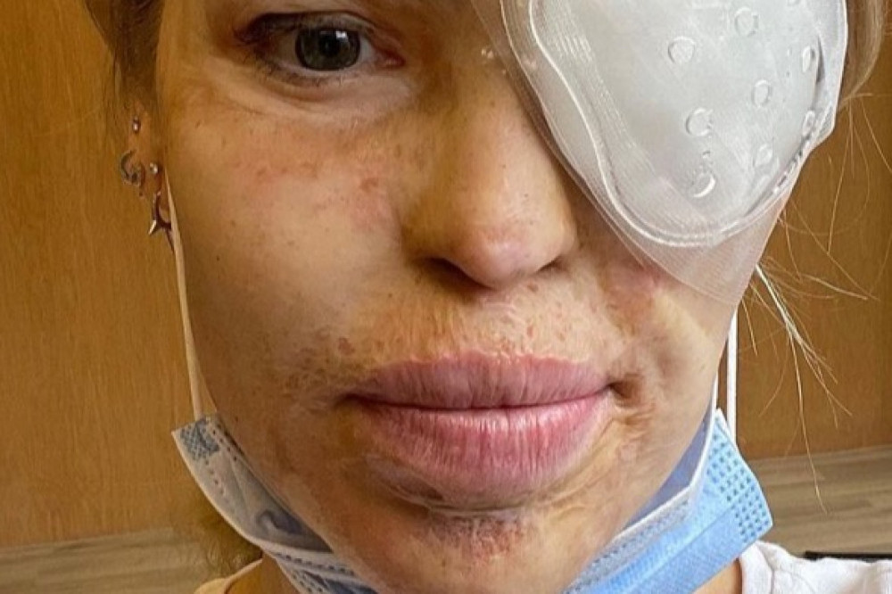 Katie Piper is back on TV days after being rushed to hospital for an emergency eye operation