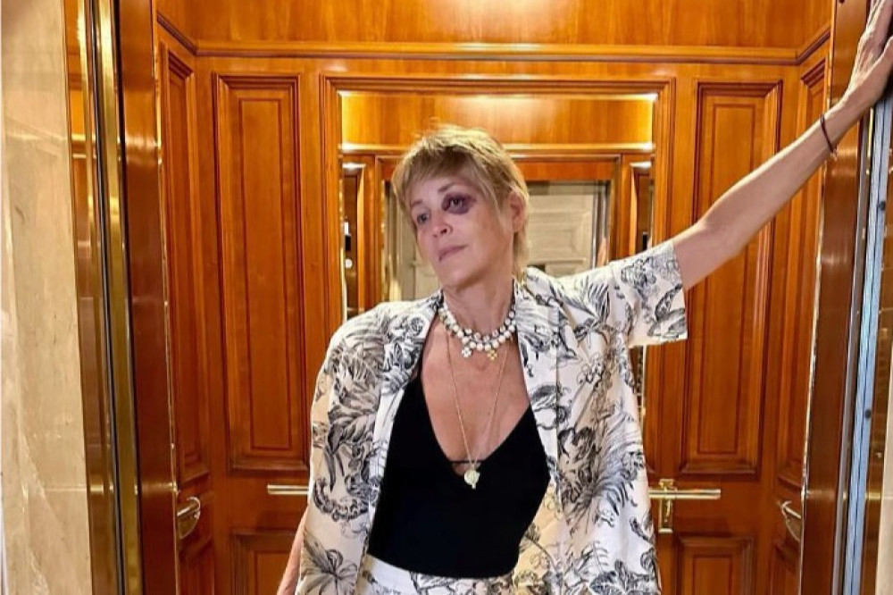 Sharon Stone has a black eye (c) Instagram