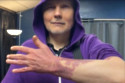 Billy Corgan has shown off his birthmark