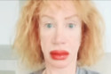 Kathy Griffin has stunned fans by showing off the swollen results of getting her lips tattooed red