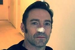 Hugh Jackman being treated for skin cancer again