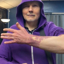 Billy Corgan has shown off his birthmark