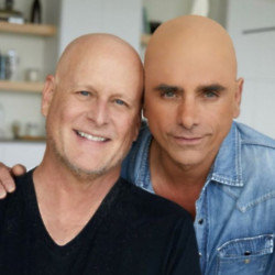 John Stamos wore a bald cap to support Dave Coulier