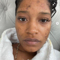 Keke Palmer (c) Instagram