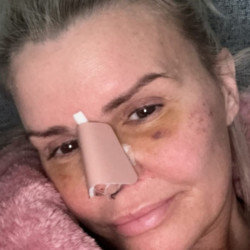 Kerry Katona is facing a long recovery after her nose surgery