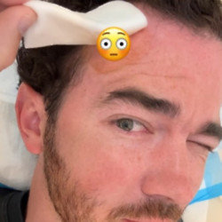 Kevin Jonas had skin cancer treatment (c) Instagram