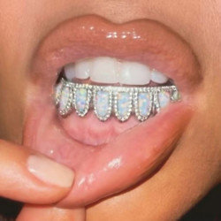 Kim Kardashian West's grill (c) Instagram