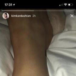 Kim Kardashian West's leg (c) Instagram 