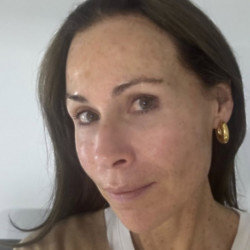 Minnie Driver has joined the growing number of Hollywood stars going fresh-faced